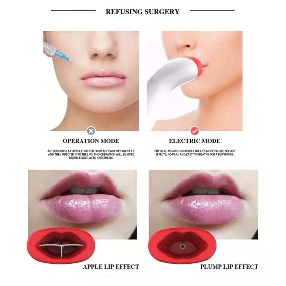 Automatic Silicone Lip Plumper Device  Fuller-looking lips. No needles.